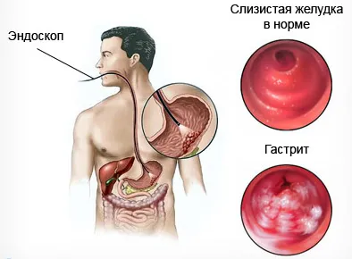 лікування
