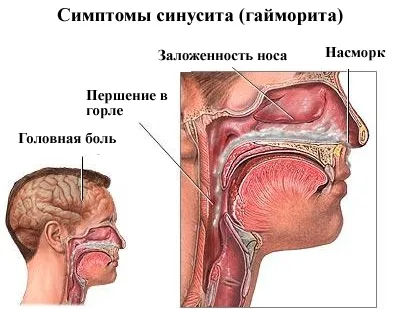 жіноче здоров'я