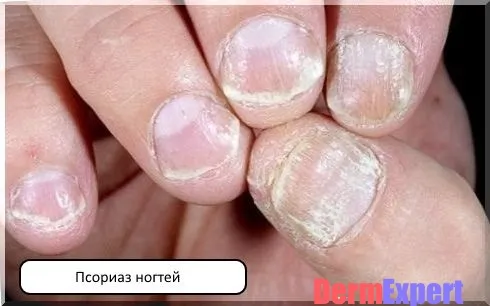 правило