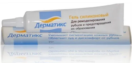 як позбутися від шрамів після вітрянки