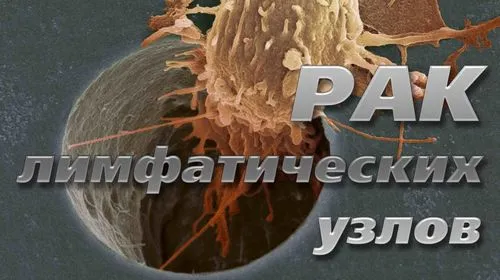 як лікувати рак лімфовузлів народними засобами