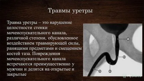 профілактика і розрив уретри