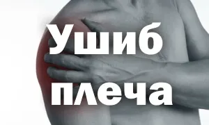 лікувати забій плеча