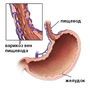 ступеня
