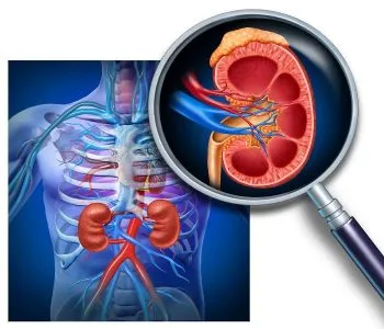 як лікувати стеноз ниркової артерії