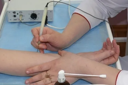 як лікувати папіломи у дитини