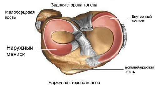 як лікувати медіальний меніск