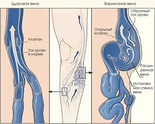 психосоматика