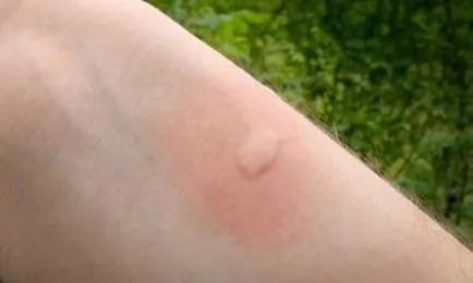 Ceea ce se tem de țânțari și musculițe care miros repels țânțari, fotografii și video (țânțari) Ceea ce se tem de țânțari și musculițe care miros repels țânțarii, foto și video