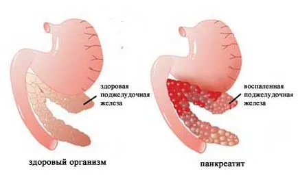 Durerea deasupra buricului - o trecere în revistă a motivelor (motivul pentru durerea de deasupra ombilicului) Durerea deasupra buricului - o trecere în revistă a motivelor