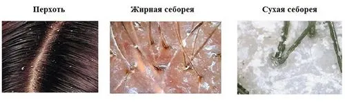 шампуні