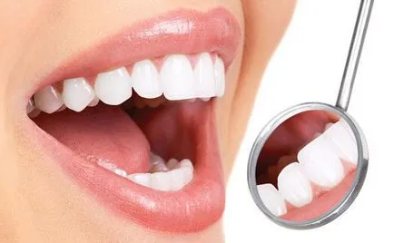 Ce este sigilarea dintilor de etanșare dentare la copii
