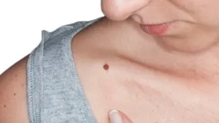 Cum sunt alunite misticismului și numai (piele De ce sunt noi) Cum sunt alunite misticism și numai