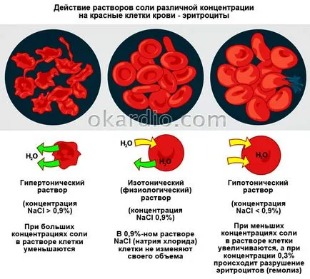 soluție hipertonică că este atunci când este utilizat ca preparat (hipertonică) soluție hipertonică este ceea ce este, atunci când sunt utilizate, cum să gătească