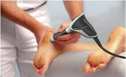 Sarokcsontsarkantyú fiziolechenie (sarok) Calcaneus homlok rehabilitáció