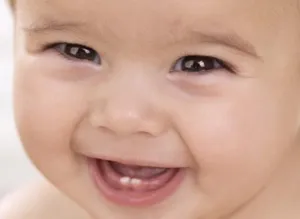 Mivel a fogak kezdenek mászni Mivel a fogak kezdenek mászni