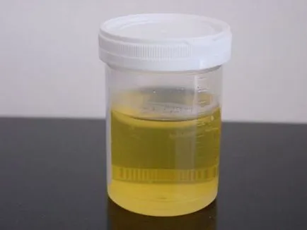 Escherichia coli kezelés