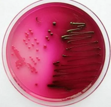 Escherichia coli kezelés