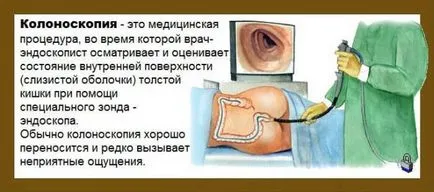 Hogyan készüljünk fel a kolonoszkópia Hogyan készüljünk fel a kolonoszkópia