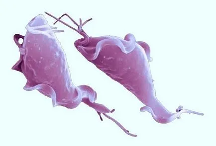 Reakcióvázlat kezelésére trichomoniasis Reakcióvázlat kezelésére trichomoniasis