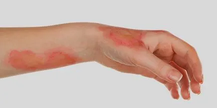 Mi szükséges a nátrium-klorid Mi szükséges a nátrium-klorid