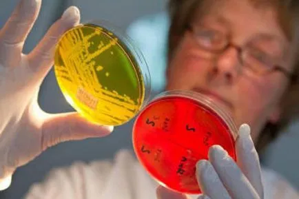 Staphylococcus aureus, mi ez