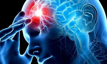 Halál stroke tüneteit, statisztika