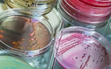 Reakcióvázlat kezelésére trichomoniasis