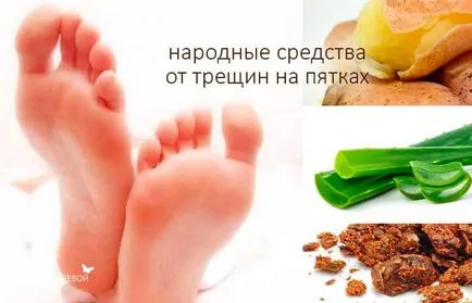 Mit jelentenek a repedt sarkú Mit jelentenek a repedt sarkú