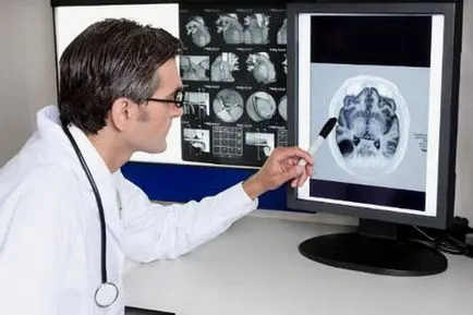 Az intracranialis nyomás csecsemőkben kezelt