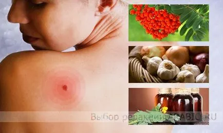 10 tipp, hogy megszabaduljon a szemölcsök otthon, mint a kijelző népi szemölcs (szemölcs) 10 tipp, hogy megszabaduljon a szemölcsök otthon, hogyan lehet egy szemölcs népi