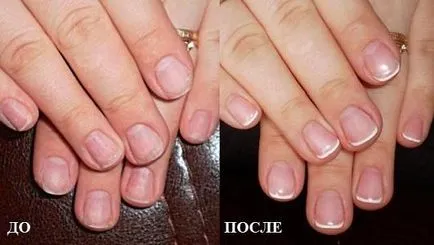 Bio-gél körömlakk - mi ez, és mi az,