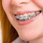 Merevítők a választ a gyakran ismételt kérdéseket, történetek valódi emberek (válaszok) Merevítők a választ a gyakran ismételt kérdéseket, történetek valódi emberek
