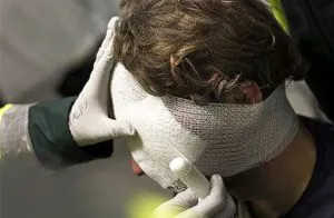 Tserebrastenicheskom szindróma (encephalasthenia) a gyermekek és felnőttek, a tünetek és a kezelés (tserebrastenicheskom) Tserebrastenicheskom szindróma (encephalasthenia) a gyermekek és felnőttek, a tünetek és a kezelés