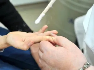 A jobb eltávolítani papilloma jobb módszerek