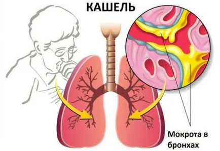 Mint köhögés kezelésére csecsemők, újszülöttkori orvostudomány és eszközök