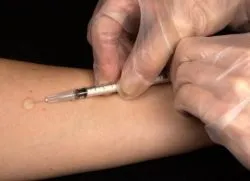 Mi történik, ha nedves bőr teszt