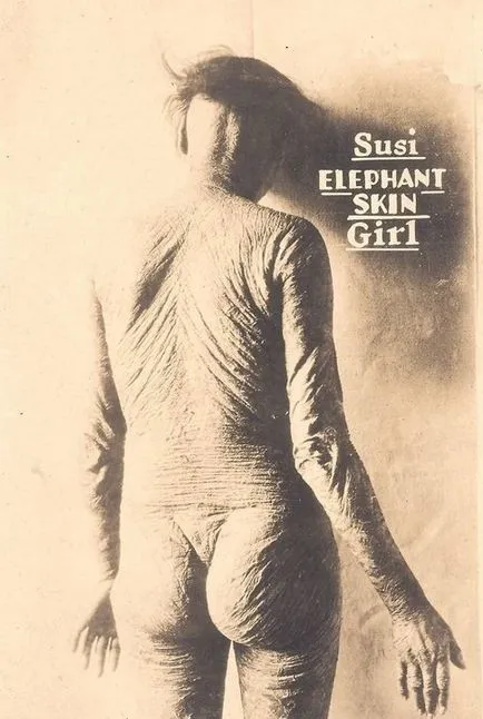 Lány rák, élő csontváz, félig ember és más cirkuszi furcsaság (Circus) Lány rák, élő csontváz, félig ember és más cirkuszi furcsaság