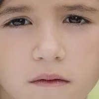Eltért septum - okai, típusai, tünetei, hatásai, kezelések (septum) Eltért septum - okai, típusai, tünetei, hatásai, kezelések