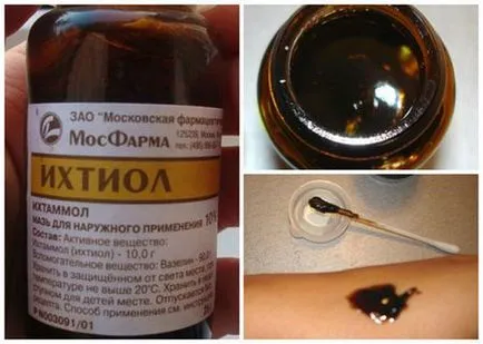 Ihtiolovaya kenőcs pattanások - véleménye, az arc, az alkalmazás módja, útmutató, segít, szubkután (arc) Ihtiolovaya kenőcs pattanások - véleménye, az arc, az alkalmazás módja, útmutató, segít, szubkután