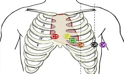 Hogyan lehet az EKG