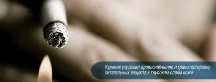Hogy, hogy nem kap öreg
