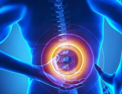 Spinalis stenosis (degeneratív, abszolút relatív), hogy ez (degeneratív) Spinalis stenosis (degeneratív, abszolút relatív), hogy