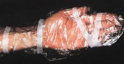 Alapok a hegek népi technikák vagy kenőcs (azt jelenti, hegek heg krémet vélemény Kontraktubeks eltávolítása kenőcs orvoslás kezelés arc) Alapok a hegek népi technikákkal vagy kenőcs
