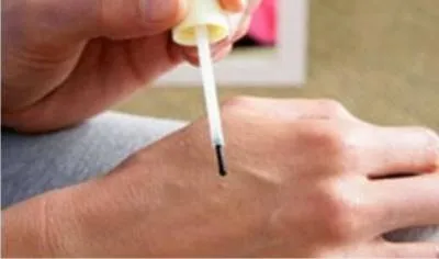 Hogyan lehet eltávolítani a papilloma, annál jobb, hogy az emberek pénzét (papilloma) Hogyan lehet eltávolítani a papilloma, annál jobb, hogy az emberek pénzét