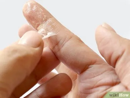 Hogyan lehet eltávolítani a pillanatragasztó a kezében (ragasztó alkalmas arra, hogy hagyja abba) Hogyan lehet eltávolítani a pillanatragasztó a kézről