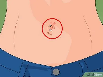 Hogyan törődik egy köldök piercing