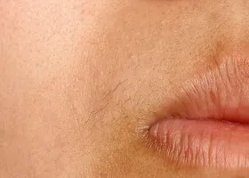 Hogyan válasszuk ki a epilátor ajánlások, az ár és video (epilátor) Hogyan válasszuk ki a epilátor ajánlások, az ár és videó