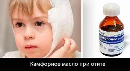 Kámfor-olaj -, amelyet használnak, hogy gyógyít (kámfor) Kámforolaj - miért használja, hogy kezeli