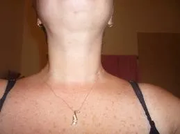 Mi megvakarta az állát öröm jele (jel) Mi az állát vakargatta szerencse öröm